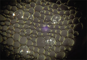Adipocytes cristallisés
